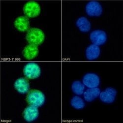CCR5 Rabbit anti-Human, Clone: V14/2, Novus Biologicals 0.025 mg; Unconjugated:Antibodies,